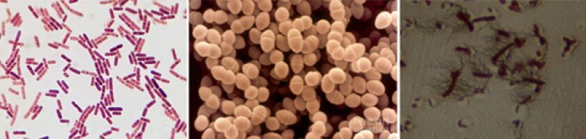 Escherichia coli, fecal enterococci and proteus are the main causative agents of chronic bacterial prostatitis
