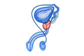 prostate inflammation drawing